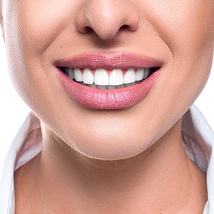 Woman’s beautiful smile after choosing a cosmetic dentist in Huntington Beach