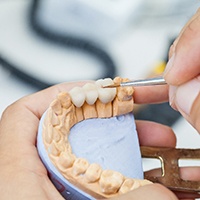 dental technician with dental bridges in Huntington Beach 