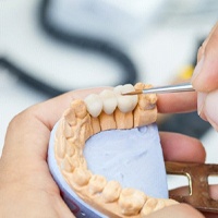 dentist in Huntington Beach designing a dental bridge