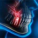 X-ray illustration of a toothache in Huntington Beach