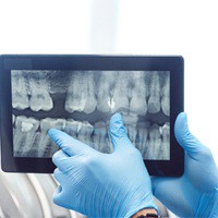 dentist with X-ray plaaning advanced dental implant procedures in Huntington Beach