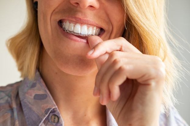 Woman inserting clear aligners