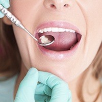 Dentist examining lady's mouth using dental mirror