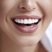 closeup smiling for cost of veneers in Huntington Beach