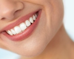 Frequently asked questions about porcelain veneers in Huntington Beach.