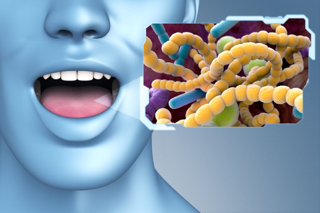 A computer-generated image of a mouth with oral bacteria